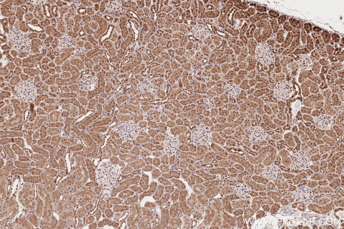Immunohistochemical analysis of paraffin-embedded rat kidney tissue slide using KHC2634 (TLK2 IHC Kit).