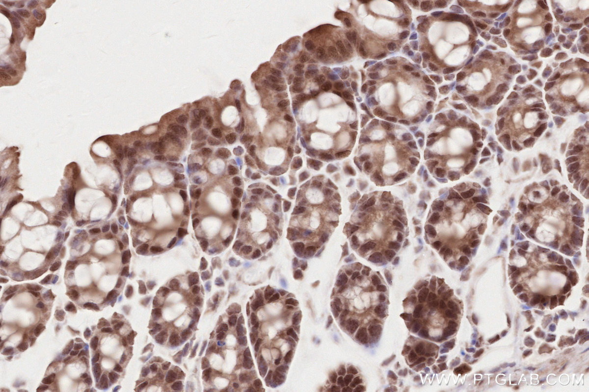 Immunohistochemical analysis of paraffin-embedded mouse colon tissue slide using KHC2634 (TLK2 IHC Kit).