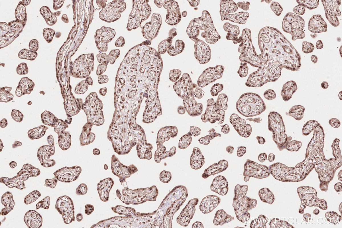 Immunohistochemical analysis of paraffin-embedded human placenta tissue slide using KHC2634 (TLK2 IHC Kit).