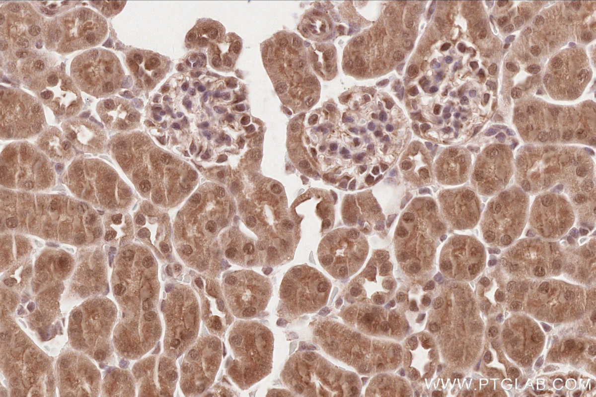 Immunohistochemical analysis of paraffin-embedded mouse kidney tissue slide using KHC2634 (TLK2 IHC Kit).