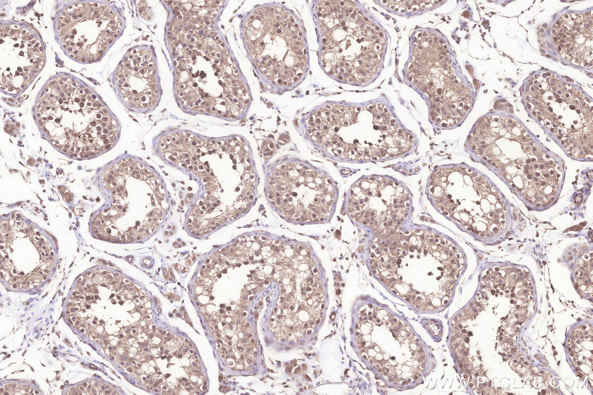 Immunohistochemical analysis of paraffin-embedded human testis tissue slide using KHC3230 (TMBIM6 IHC Kit).