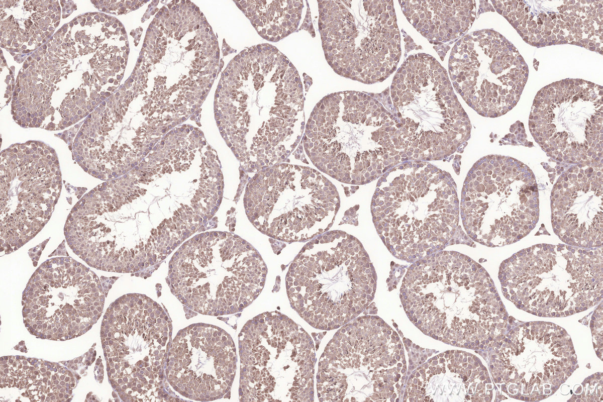 Immunohistochemical analysis of paraffin-embedded mouse testis tissue slide using KHC3230 (TMBIM6 IHC Kit).