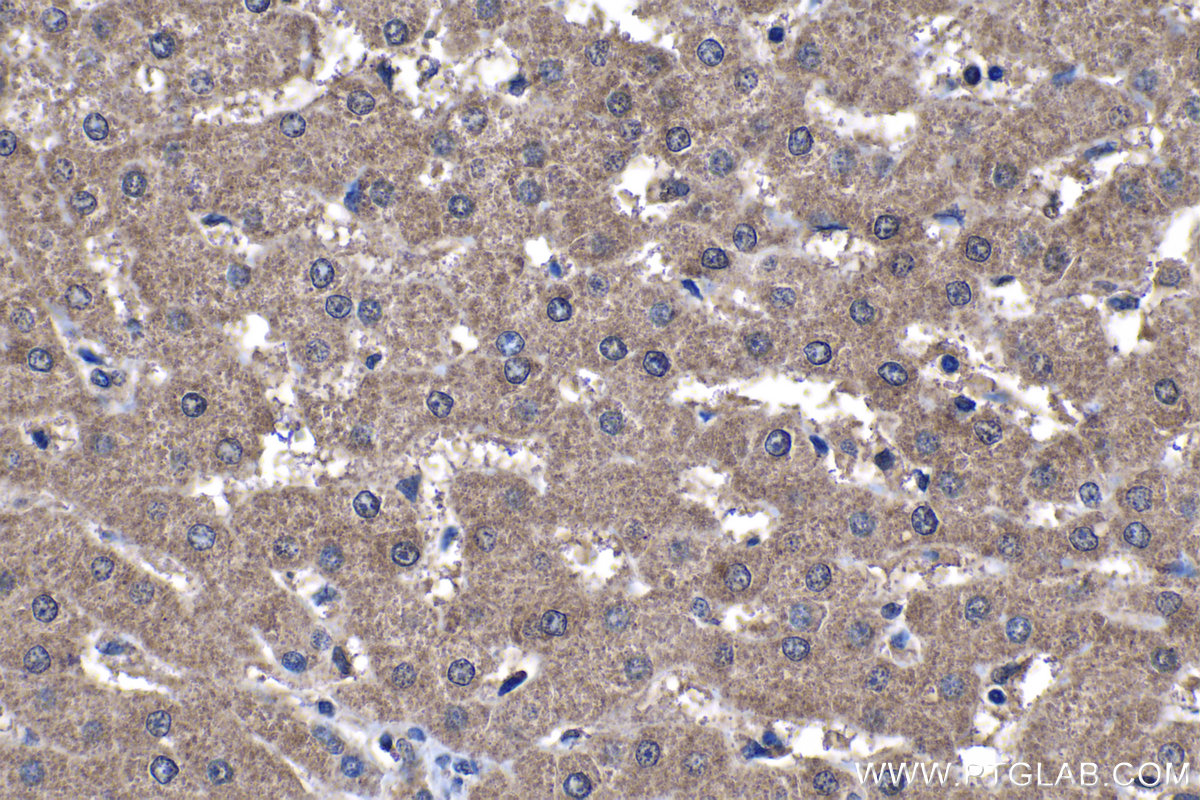 Immunohistochemical analysis of paraffin-embedded human liver tissue slide using KHC1198 (TMEM25 IHC Kit).