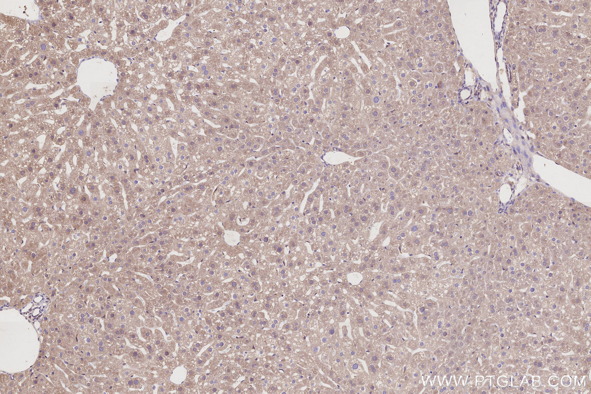 Immunohistochemical analysis of paraffin-embedded mouse liver tissue slide using KHC3236 (TMEM258 IHC Kit). Immunohistochemical analysis of paraffin-embedded mouse liver tissue slide using KHC3236 (TMEM258 IHC Kit).