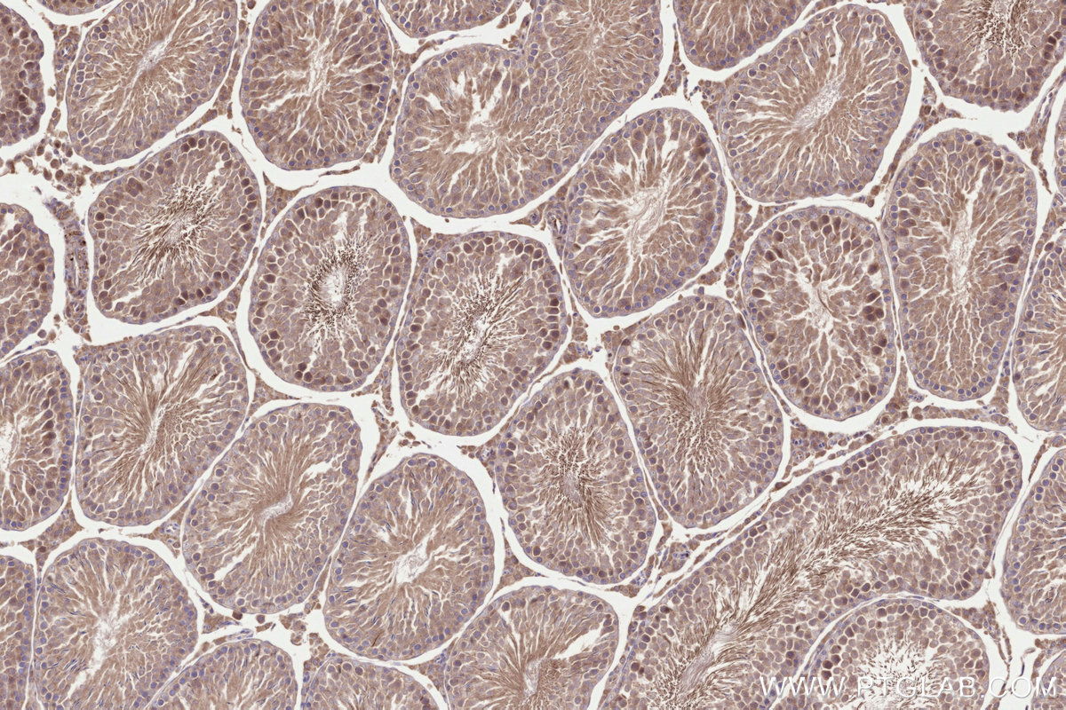 Immunohistochemical analysis of paraffin-embedded rat testis tissue slide using KHC3236 (TMEM258 IHC Kit). Immunohistochemical analysis of paraffin-embedded rat testis tissue slide using KHC3236 (TMEM258 IHC Kit).