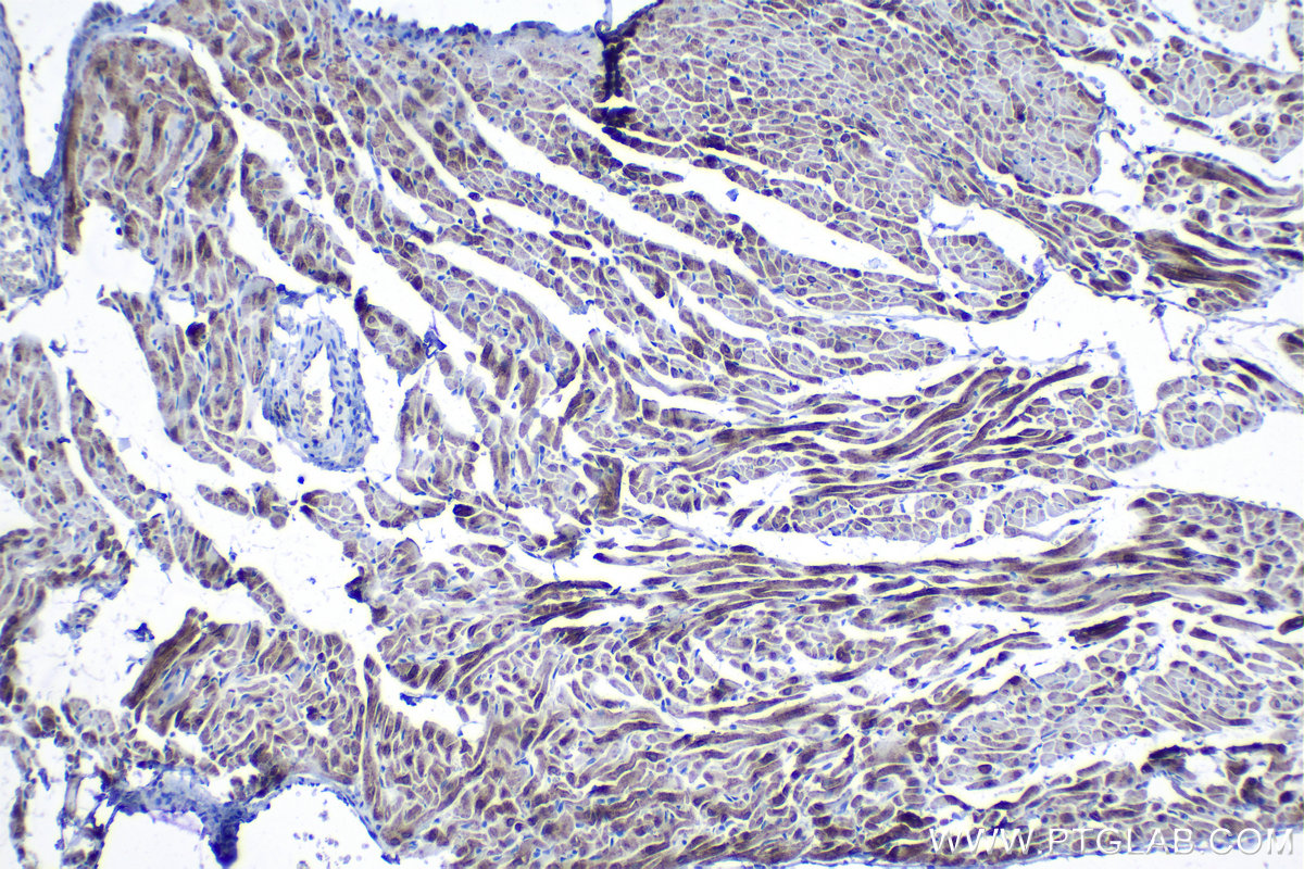 Immunohistochemical analysis of paraffin-embedded rat heart tissue slide using KHC1289 (TMEM38A IHC Kit).