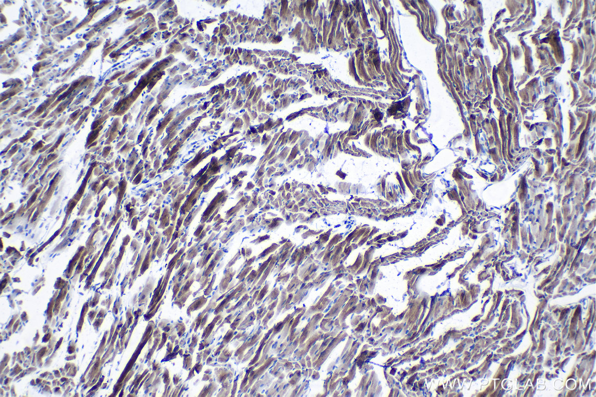 Immunohistochemical analysis of paraffin-embedded mouse heart tissue slide using KHC1289 (TMEM38A IHC Kit).