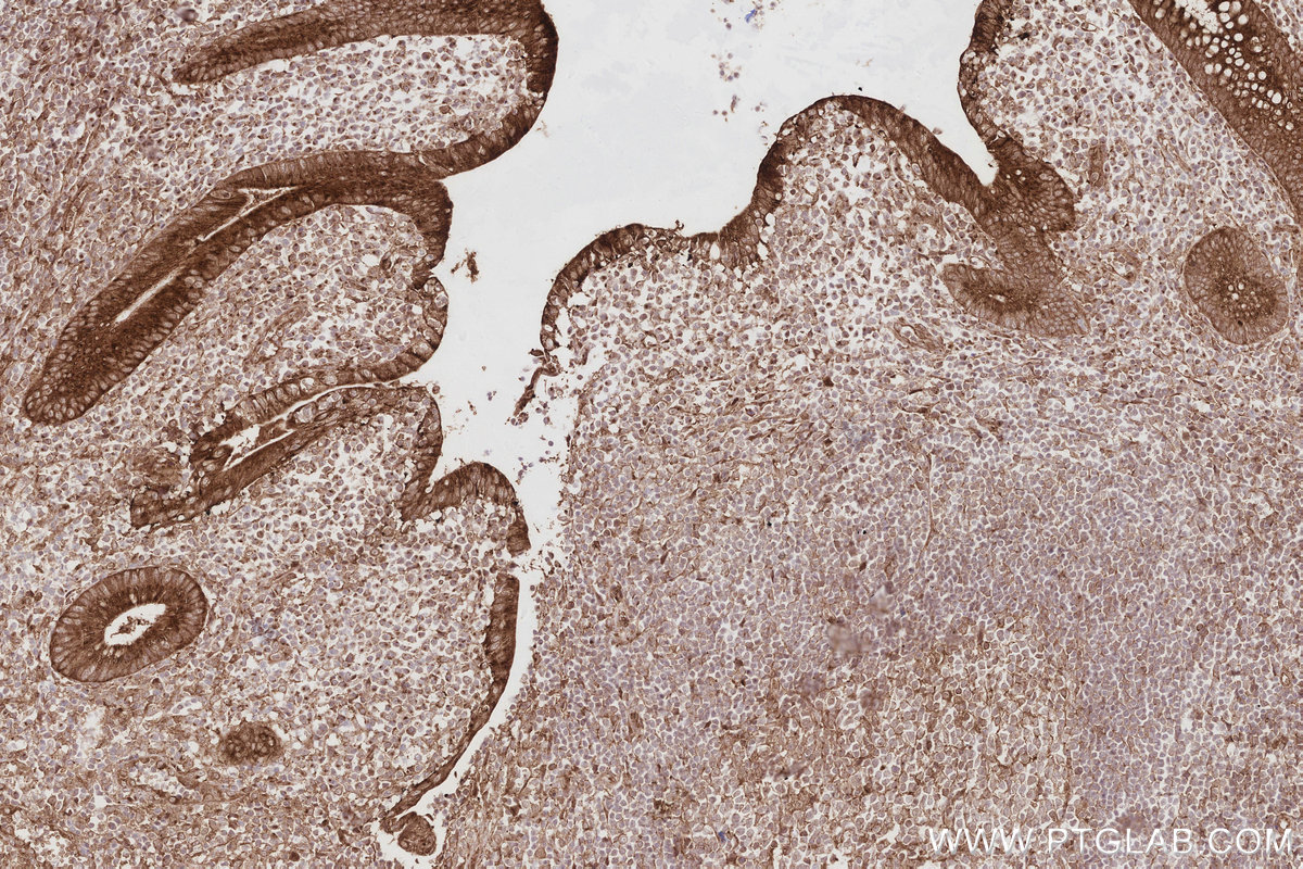 Immunohistochemical analysis of paraffin-embedded human appendicitis tissue slide using KHC2882 (TMEM59 IHC Kit).