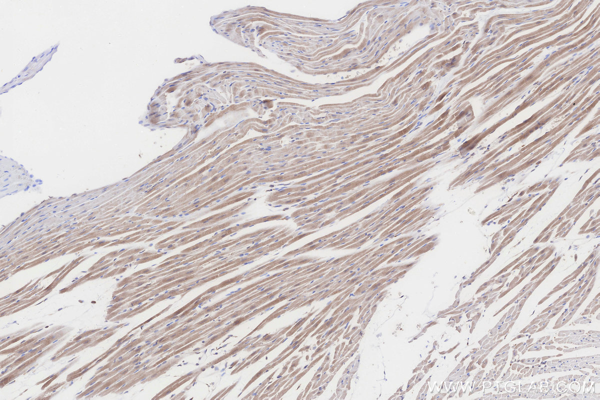 Immunohistochemical analysis of paraffin-embedded rat heart tissue slide using KHC3262 (TMEM85 IHC Kit).