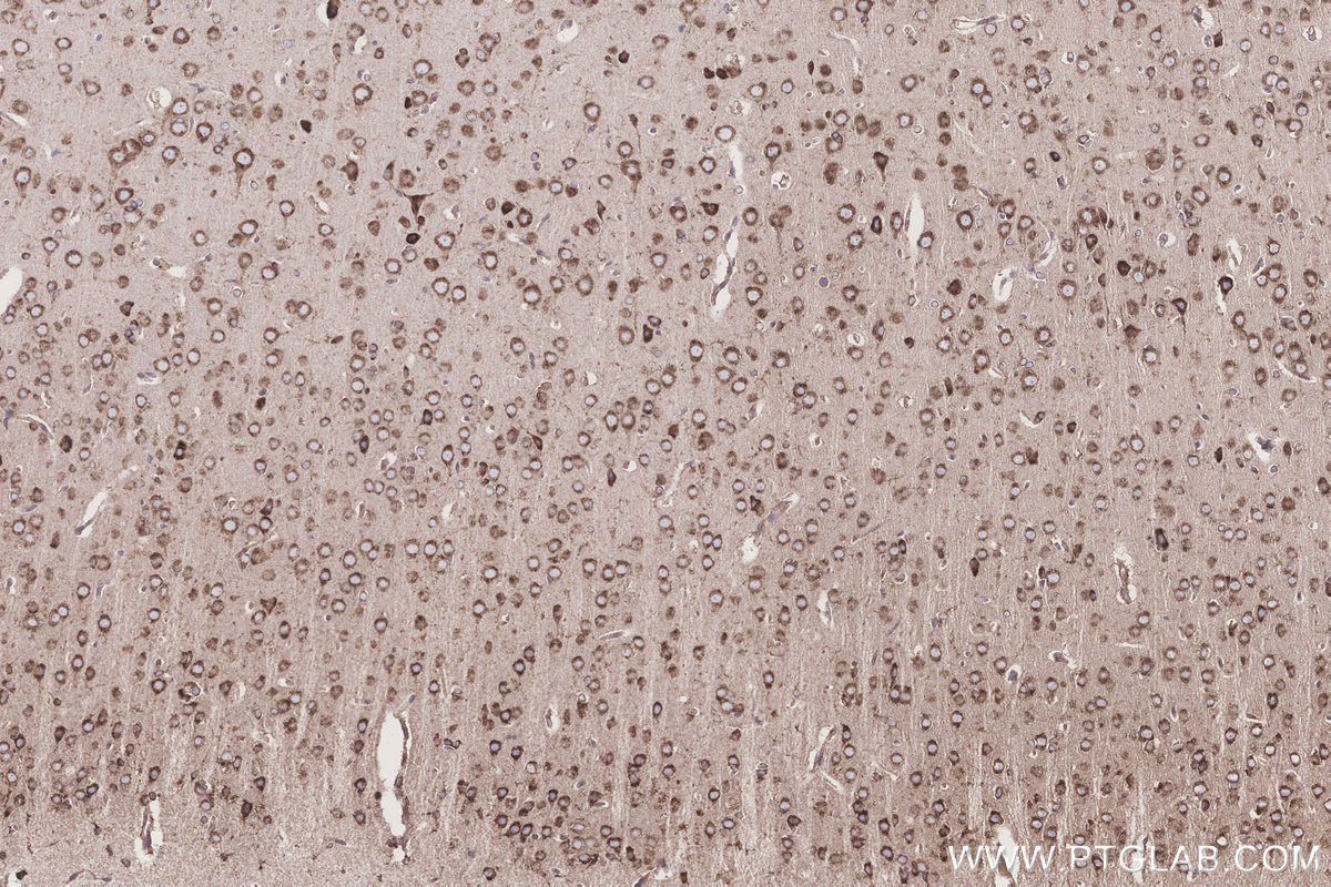 Immunohistochemical analysis of paraffin-embedded rat brain tissue slide using KHC3262 (TMEM85 IHC Kit).