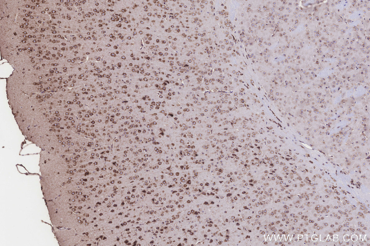 Immunohistochemical analysis of paraffin-embedded mouse brain tissue slide using KHC3262 (TMEM85 IHC Kit).