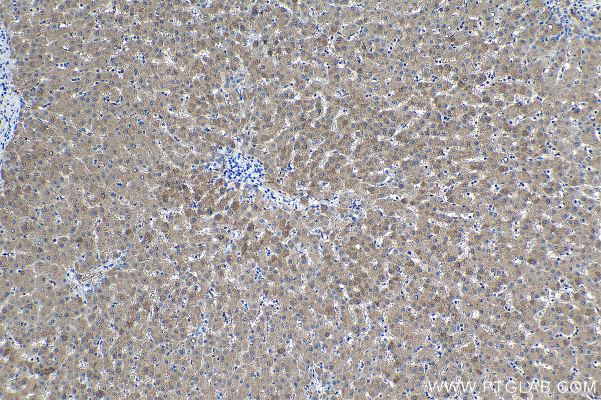 Immunohistochemical analysis of paraffin-embedded human liver tissue slide using KHC1203 (TMEM97 IHC Kit).