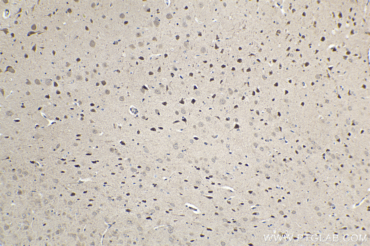 Immunohistochemical analysis of paraffin-embedded rat brain tissue slide using KHC1655 (TMF1 IHC Kit).