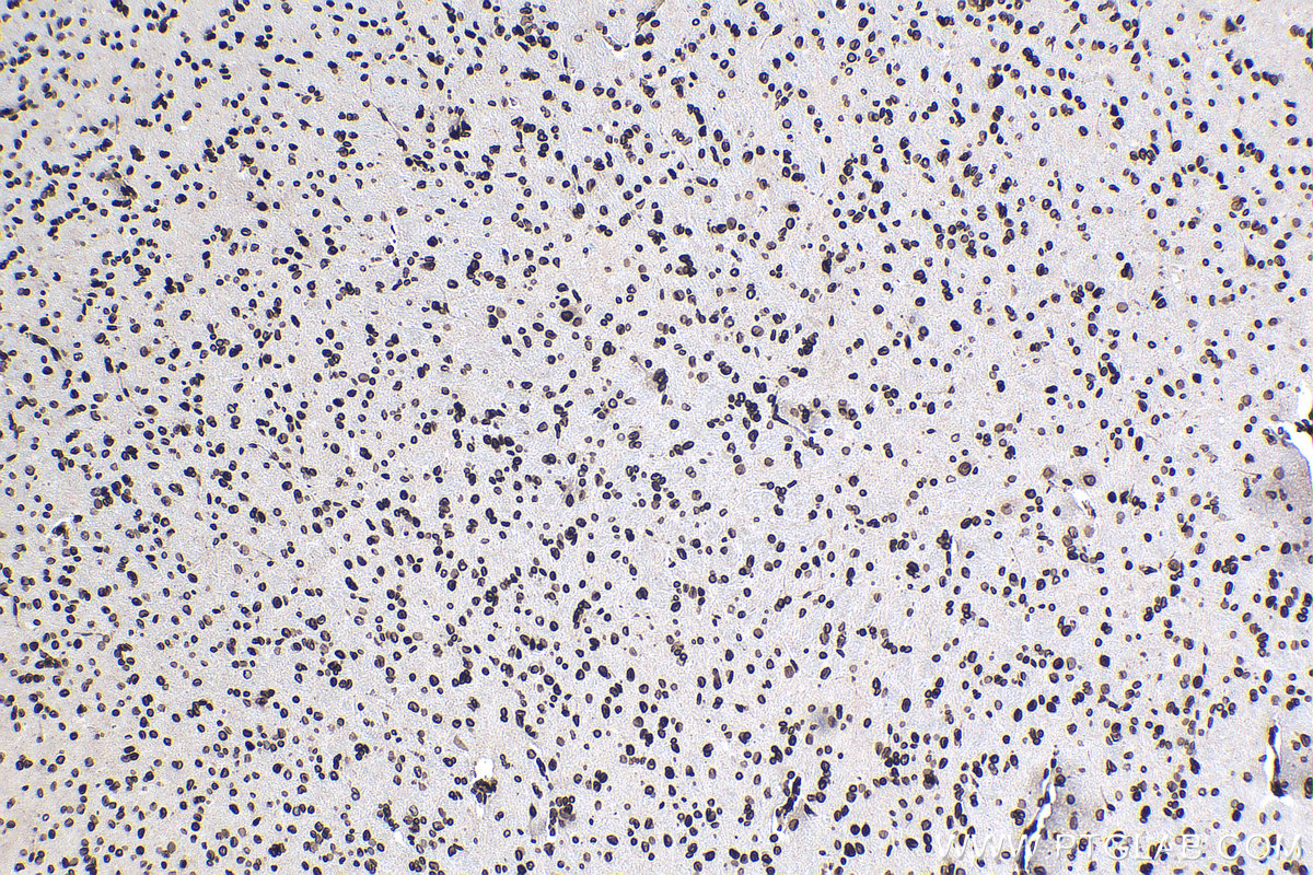 Immunohistochemical analysis of paraffin-embedded rat brain tissue slide using KHC0317 (TMPO IHC Kit).