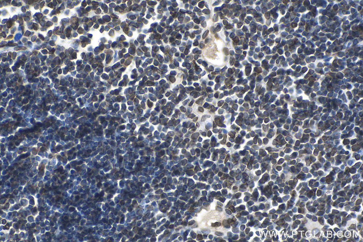 Immunohistochemical analysis of paraffin-embedded mouse thymus tissue slide using KHC0317 (TMPO IHC Kit).