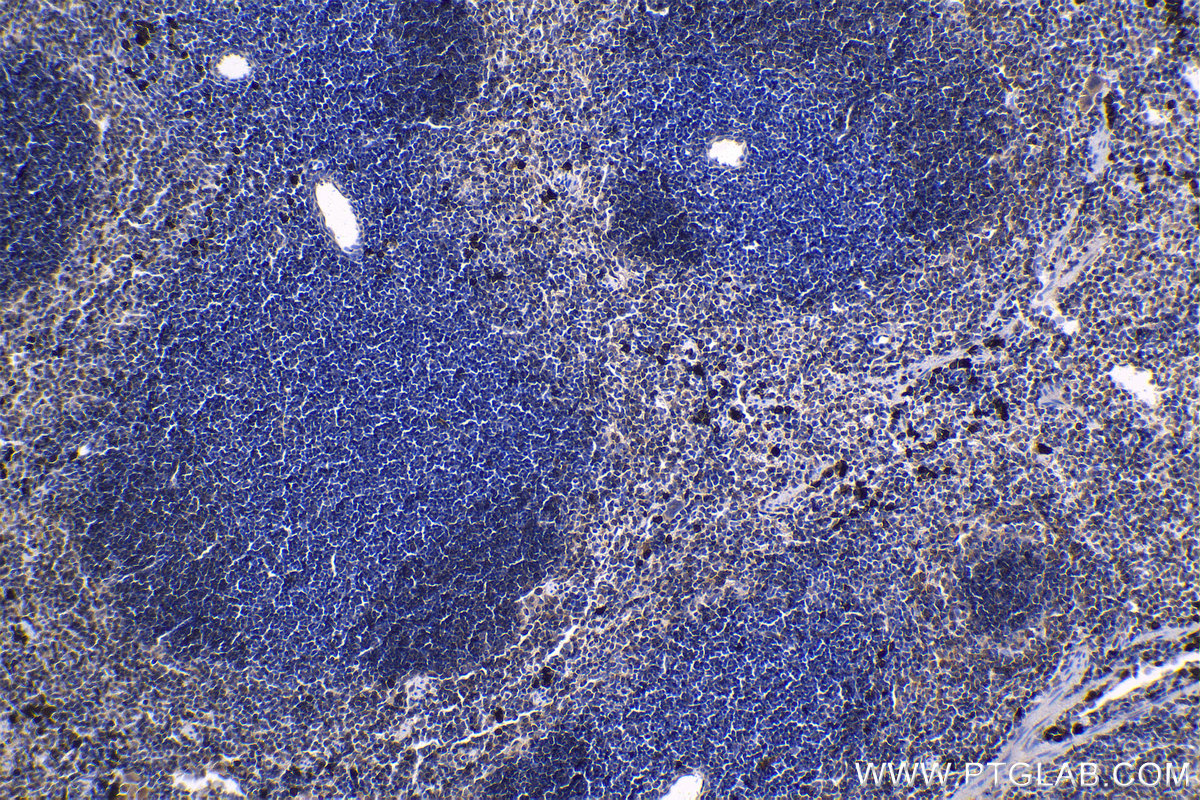 Immunohistochemical analysis of paraffin-embedded mouse spleen tissue slide using KHC1155 (TNF IHC Kit).