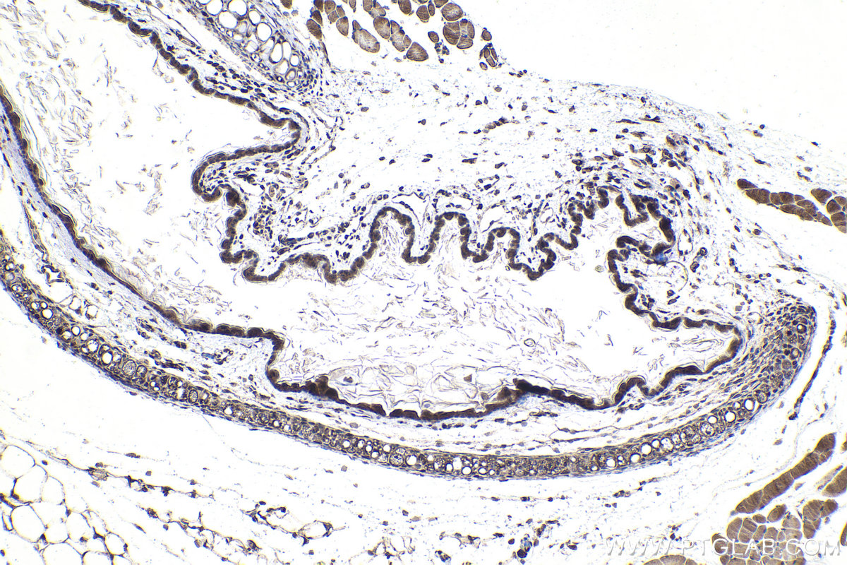 Immunohistochemical analysis of paraffin-embedded mouse skin tissue slide using KHC1747 (TNIP1 IHC Kit).