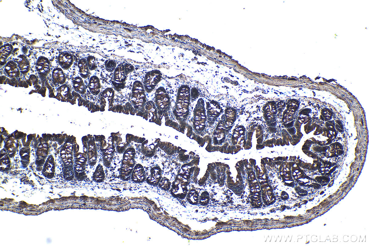 Immunohistochemical analysis of paraffin-embedded rat colon tissue slide using KHC0972 (TOLLIP IHC Kit).