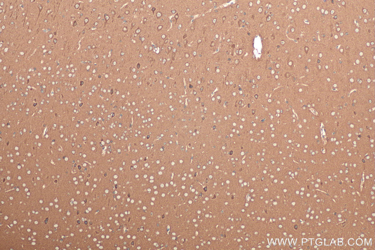 Immunohistochemical analysis of paraffin-embedded mouse brain tissue slide using KHC0972 (TOLLIP IHC Kit).