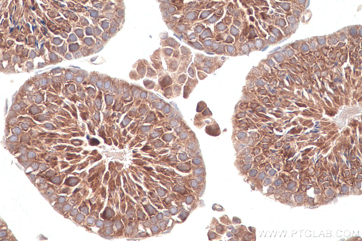 Immunohistochemical analysis of paraffin-embedded mouse testis tissue slide using KHC0857 (TOMM34 IHC Kit).