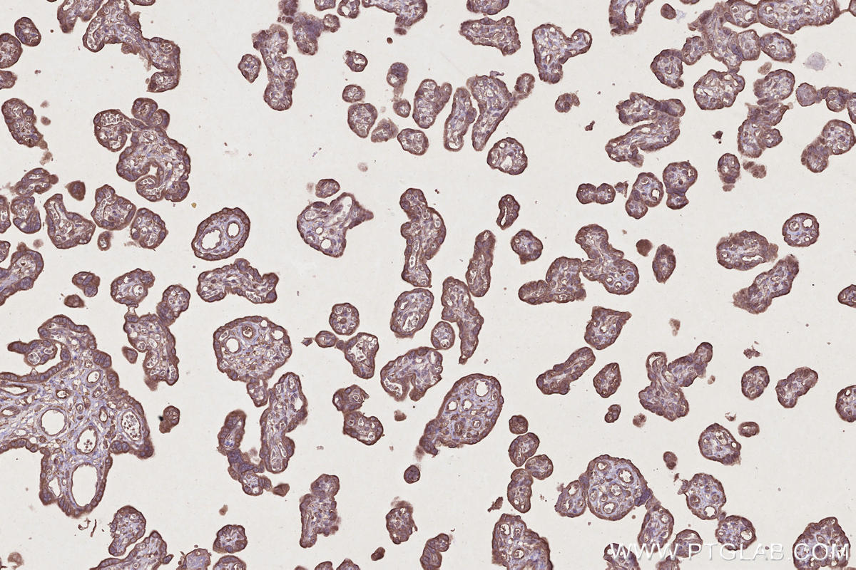 Immunohistochemical analysis of paraffin-embedded human placenta tissue slide using KHC2697 (TOR1AIP2 IHC Kit).
