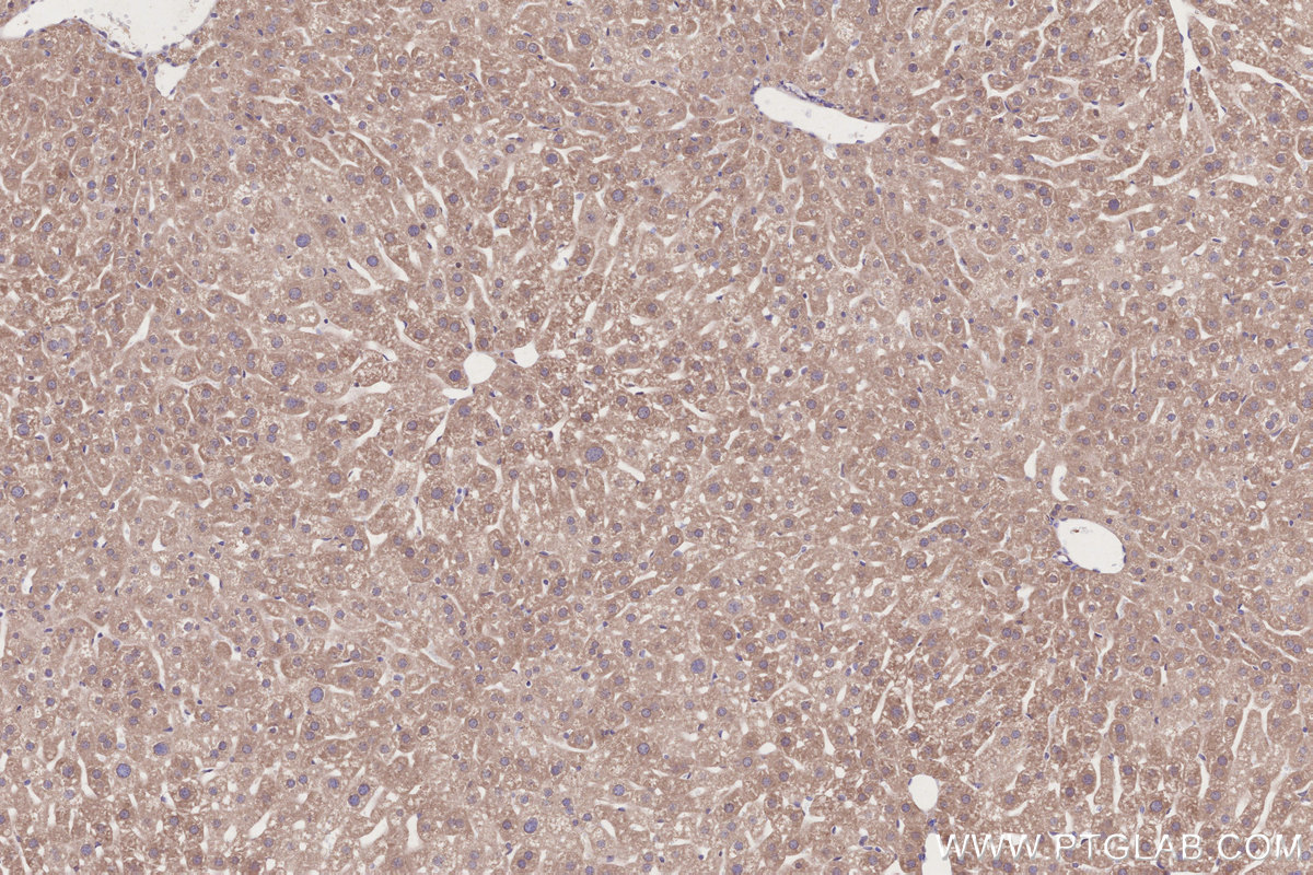 Immunohistochemical analysis of paraffin-embedded mouse liver tissue slide using KHC2697 (TOR1AIP2 IHC Kit).