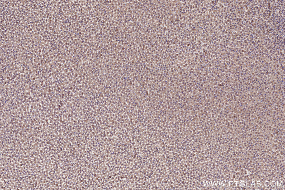 Immunohistochemical analysis of paraffin-embedded rat adrenal gland tissue slide using KHC2697 (TOR1AIP2 IHC Kit).