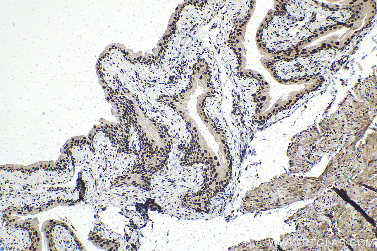 Immunohistochemical analysis of paraffin-embedded mouse bladder tissue slide using KHC1483 (TOX4 IHC Kit).