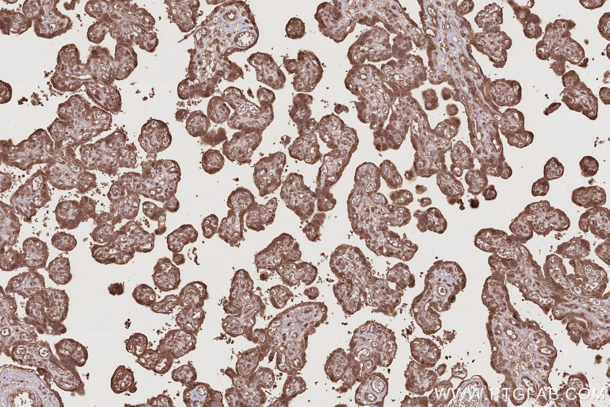 Immunohistochemical analysis of paraffin-embedded human placenta tissue slide using KHC2775 (TP53INP1 IHC Kit).