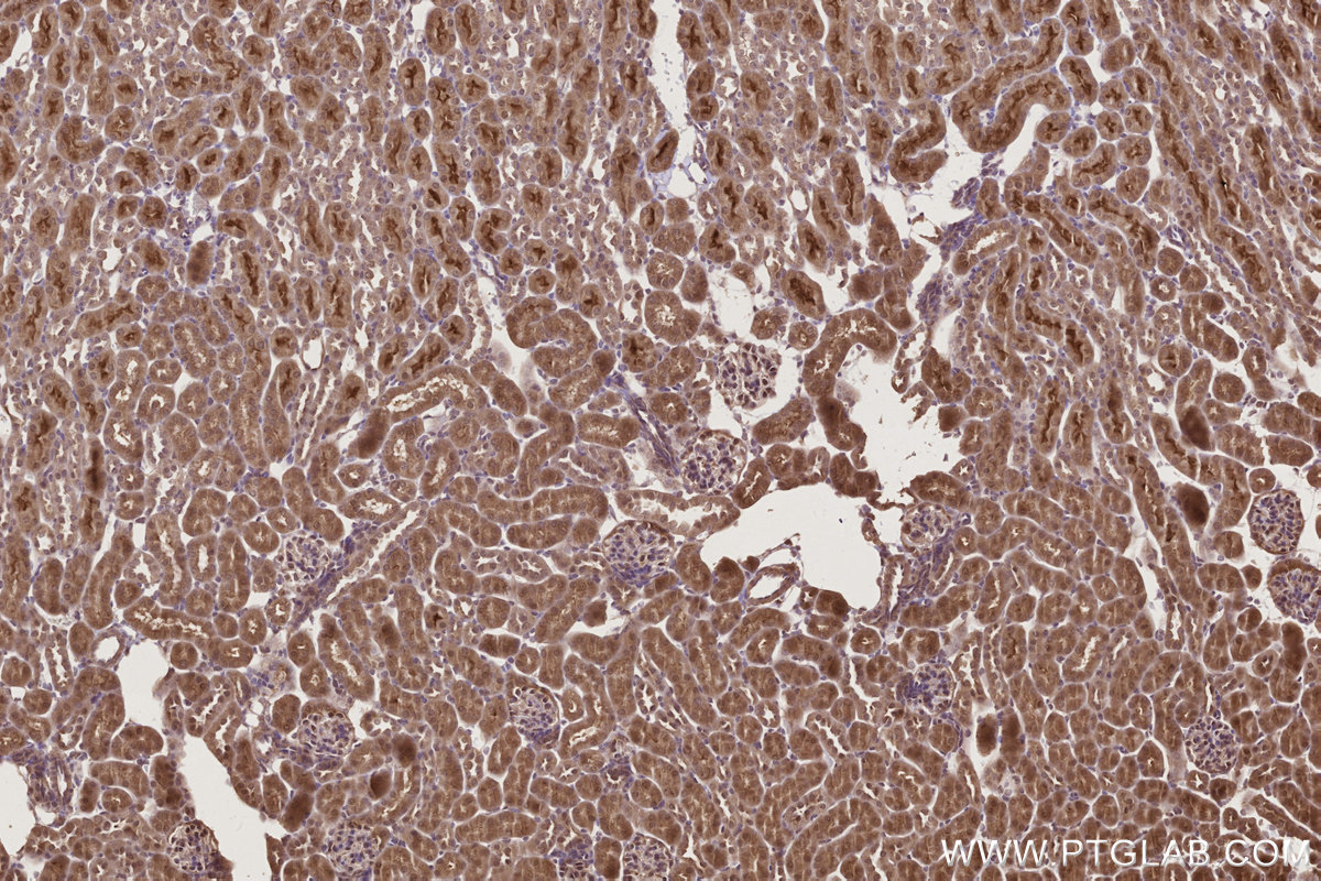 Immunohistochemical analysis of paraffin-embedded mouse kidney tissue slide using KHC2775 (TP53INP1 IHC Kit).
