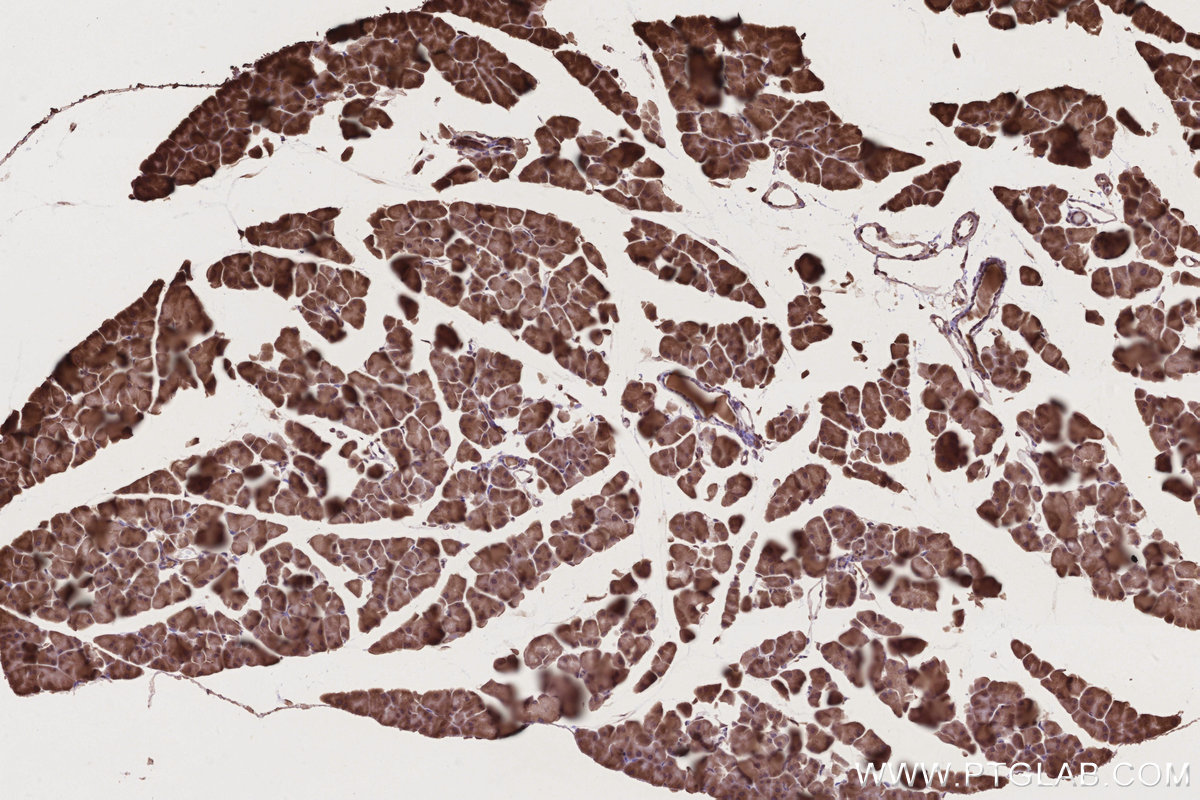 Immunohistochemical analysis of paraffin-embedded mouse pancreas tissue slide using KHC2775 (TP53INP1 IHC Kit).