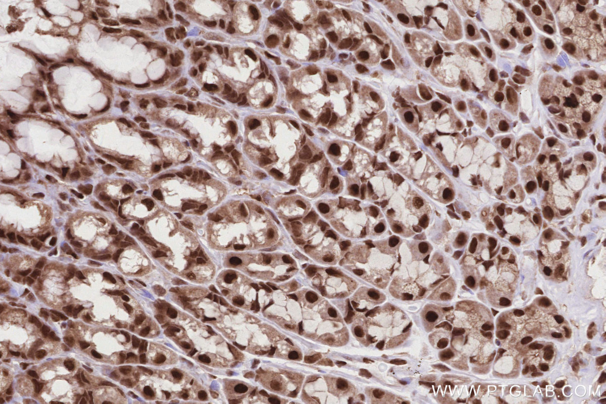 Immunohistochemical analysis of paraffin-embedded rat stomach tissue slide using KHC2832 (TP53RK IHC Kit).