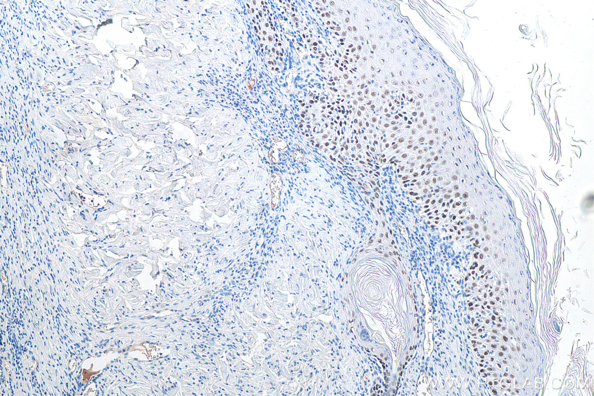 Immunohistochemical analysis of paraffin-embedded rat skin tissue slide using KHC0086 (TP63 IHC Kit).
