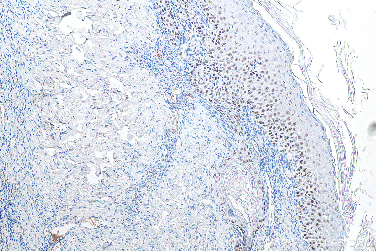 Immunohistochemical analysis of paraffin-embedded rat skin tissue slide using KHC0086 (TP63 IHC Kit).