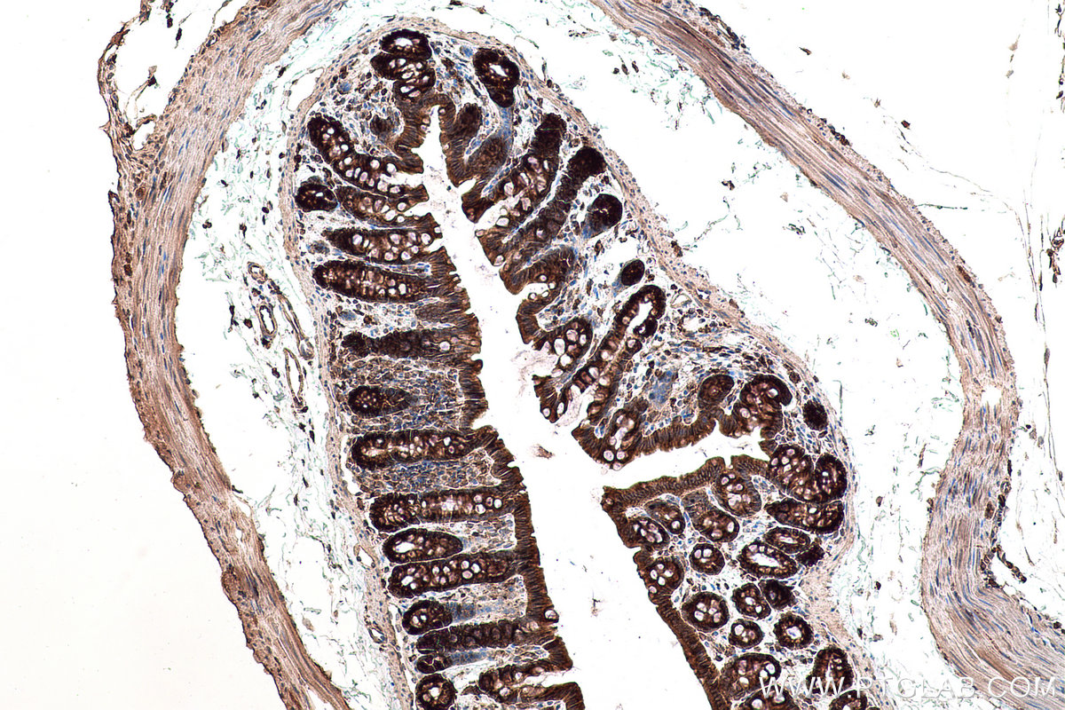 Immunohistochemical analysis of paraffin-embedded rat colon tissue slide using KHC0844 (TPD52L2 IHC Kit).