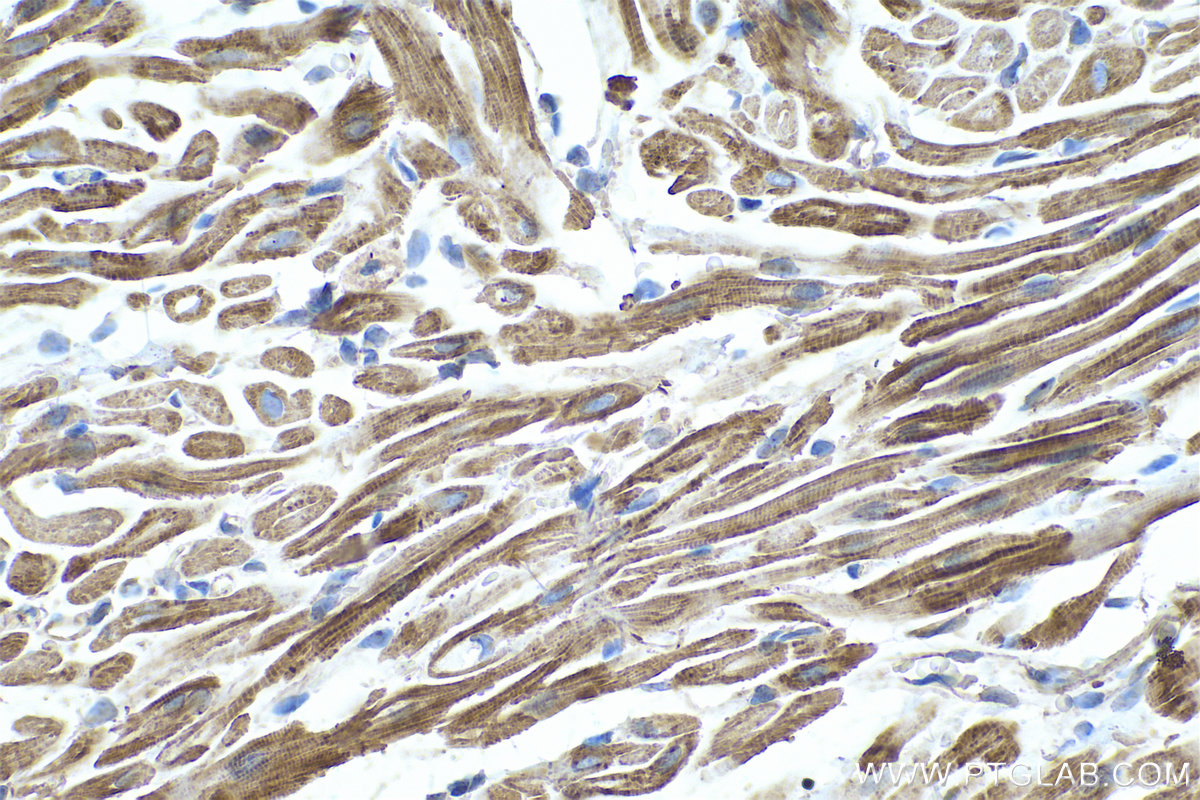 Immunohistochemical analysis of paraffin-embedded rat heart tissue slide using KHC0660 (TPM4 IHC Kit).