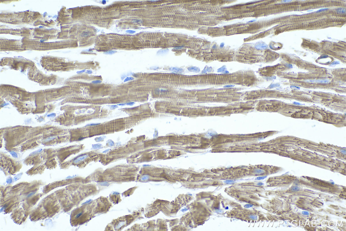 Immunohistochemical analysis of paraffin-embedded mouse heart tissue slide using KHC0660 (TPM4 IHC Kit).