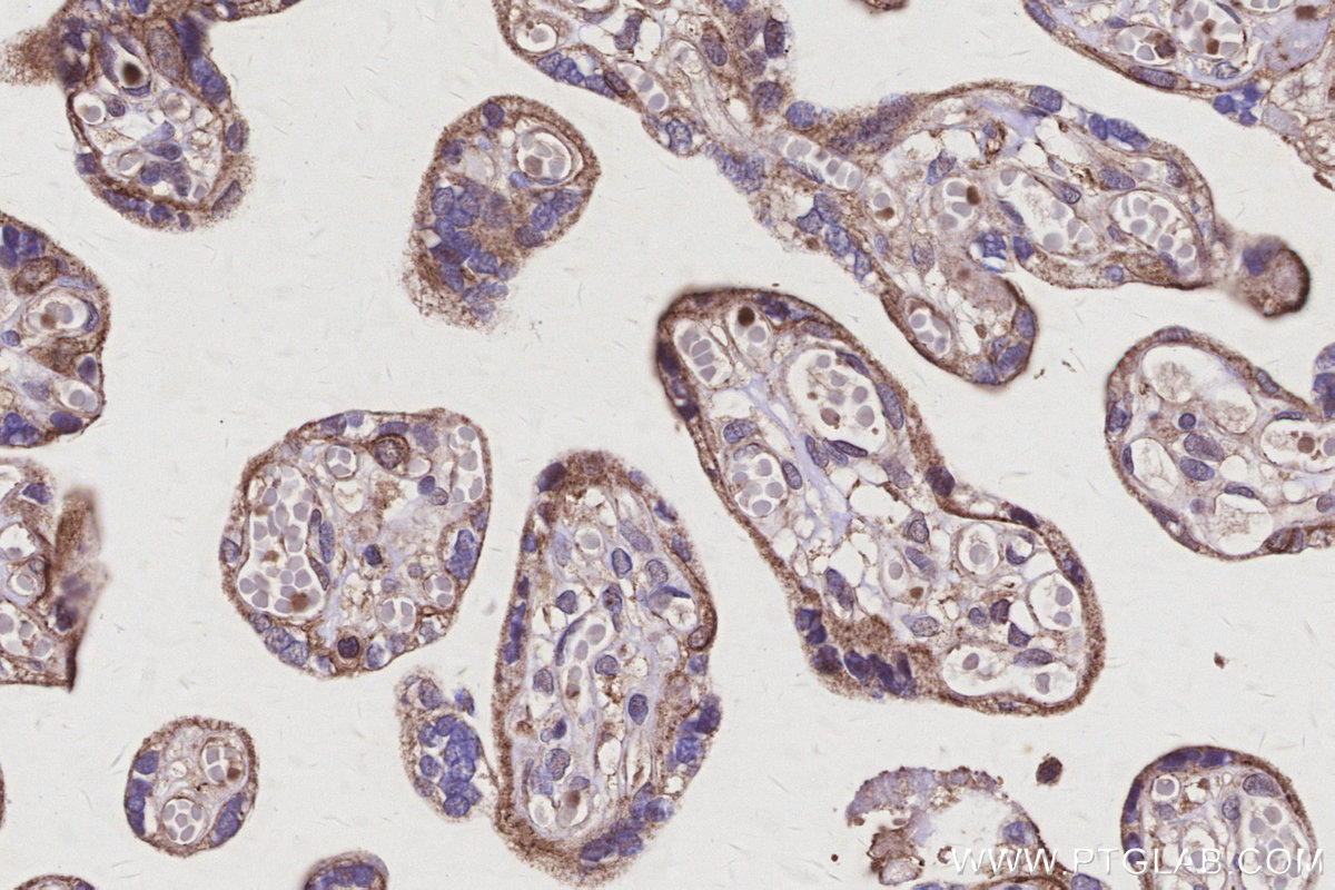 Immunohistochemical analysis of paraffin-embedded human placenta tissue slide using KHC3106 (TPRA1/GPR175 IHC Kit).