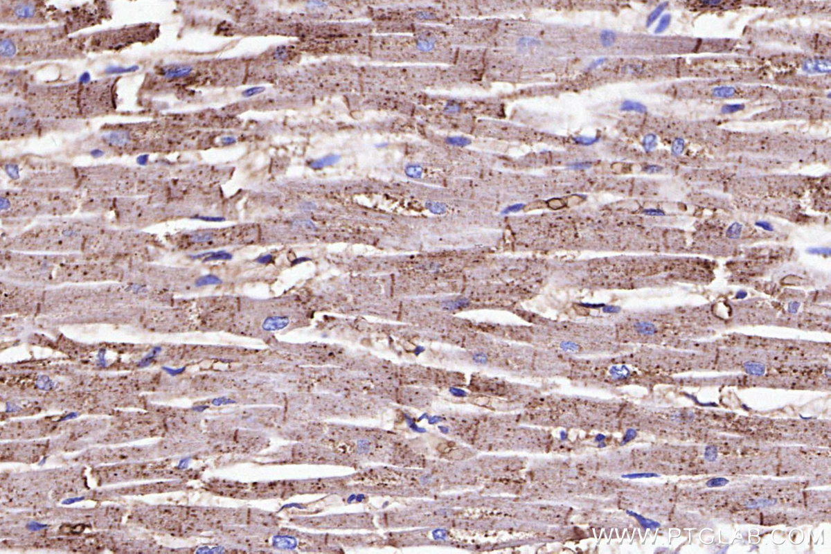 Immunohistochemical analysis of paraffin-embedded human heart tissue slide using KHC3106 (TPRA1/GPR175 IHC Kit).