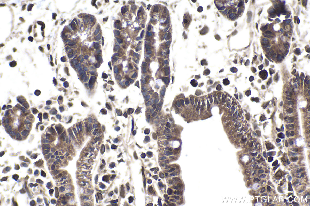 Immunohistochemical analysis of paraffin-embedded mouse small intestine tissue slide using KHC1755 (TRADD IHC Kit).