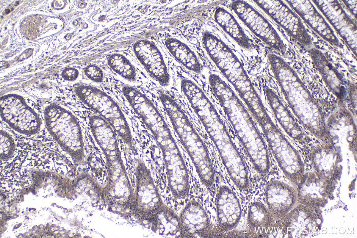 Immunohistochemical analysis of paraffin-embedded human colon tissue slide using KHC1157 (TRAF6 IHC Kit).