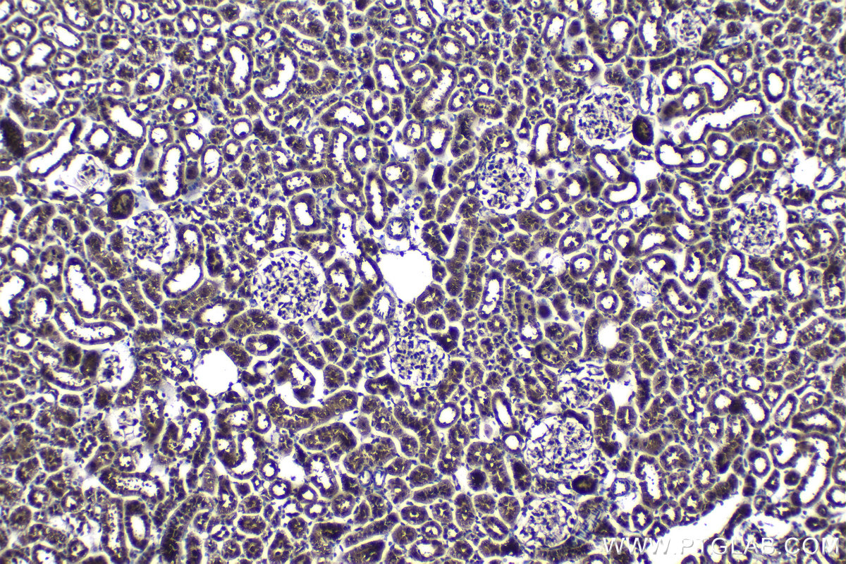 Immunohistochemical analysis of paraffin-embedded rat kidney tissue slide using KHC1157 (TRAF6 IHC Kit).