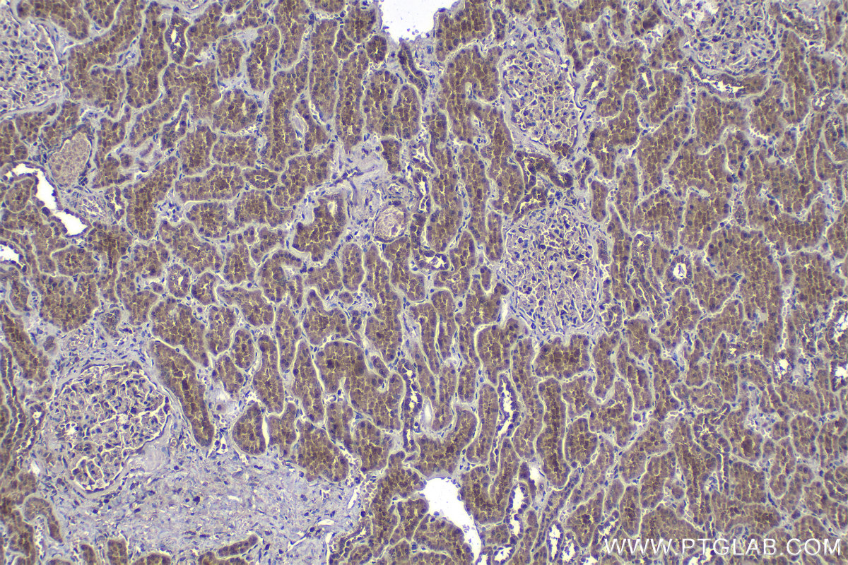 Immunohistochemical analysis of paraffin-embedded human kidney tissue slide using KHC1157 (TRAF6 IHC Kit).