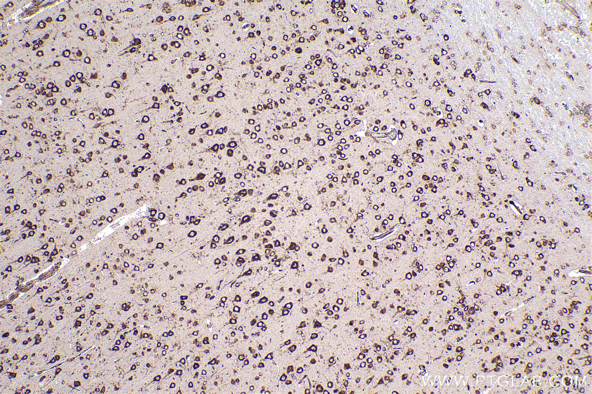 Immunohistochemical analysis of paraffin-embedded rat brain tissue slide using KHC2264 (TRAPA/SSR1 IHC Kit).