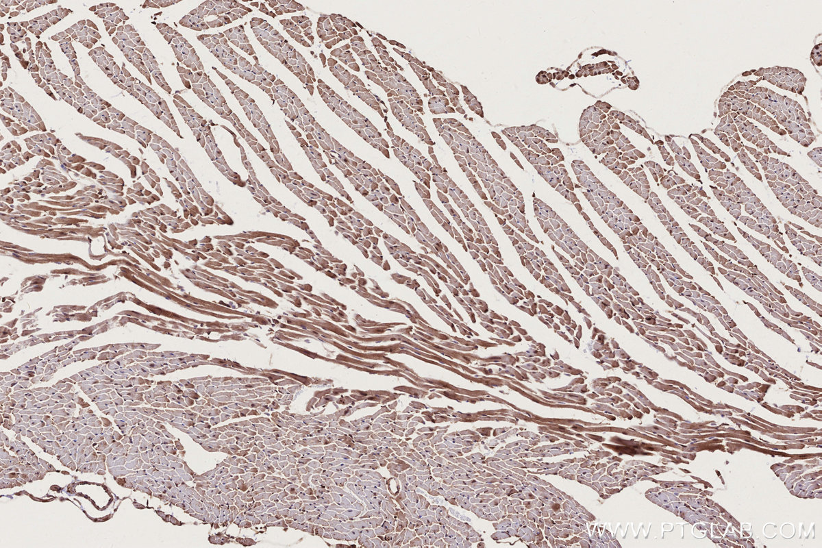 Immunohistochemical analysis of paraffin-embedded mouse heart tissue slide using KHC2790 (TRIM11 IHC Kit).