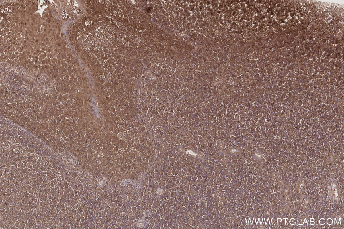 Immunohistochemical analysis of paraffin-embedded human tonsillitis tissue slide using KHC2790 (TRIM11 IHC Kit).