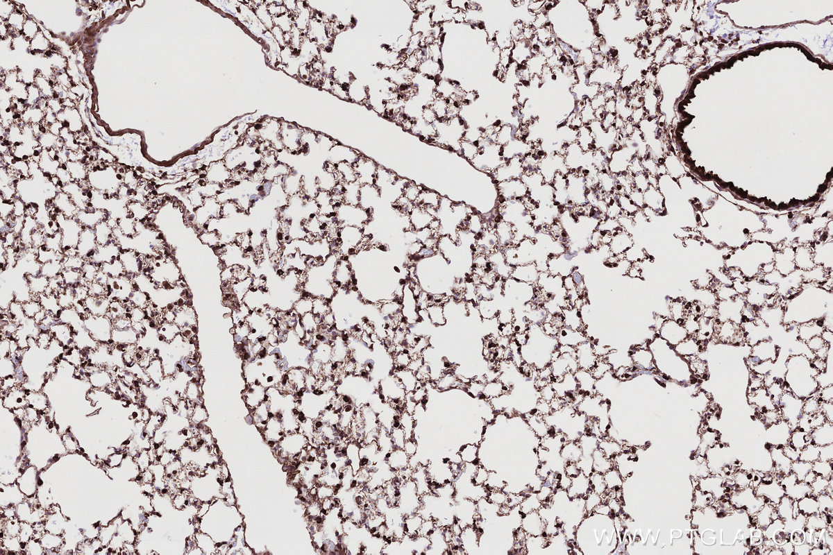 Immunohistochemical analysis of paraffin-embedded mouse lung tissue slide using KHC2790 (TRIM11 IHC Kit).