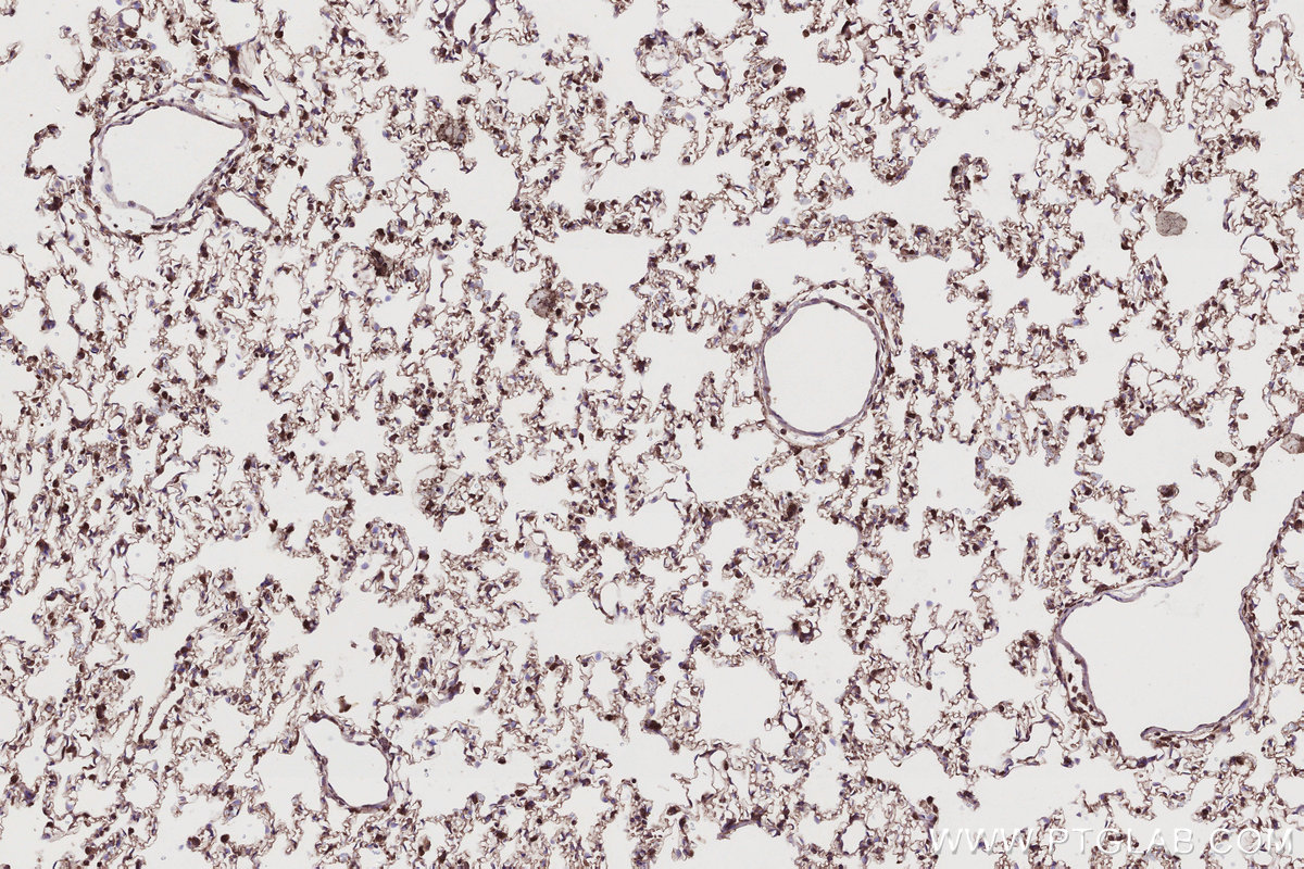 Immunohistochemical analysis of paraffin-embedded rat lung tissue slide using KHC2790 (TRIM11 IHC Kit).