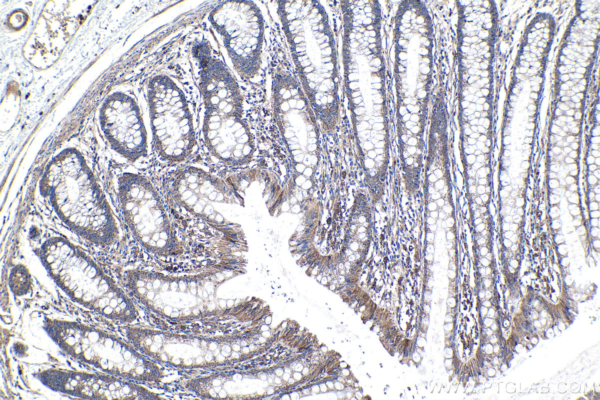 Immunohistochemical analysis of paraffin-embedded human colon tissue slide using KHC1175 (TRIM16 IHC Kit).