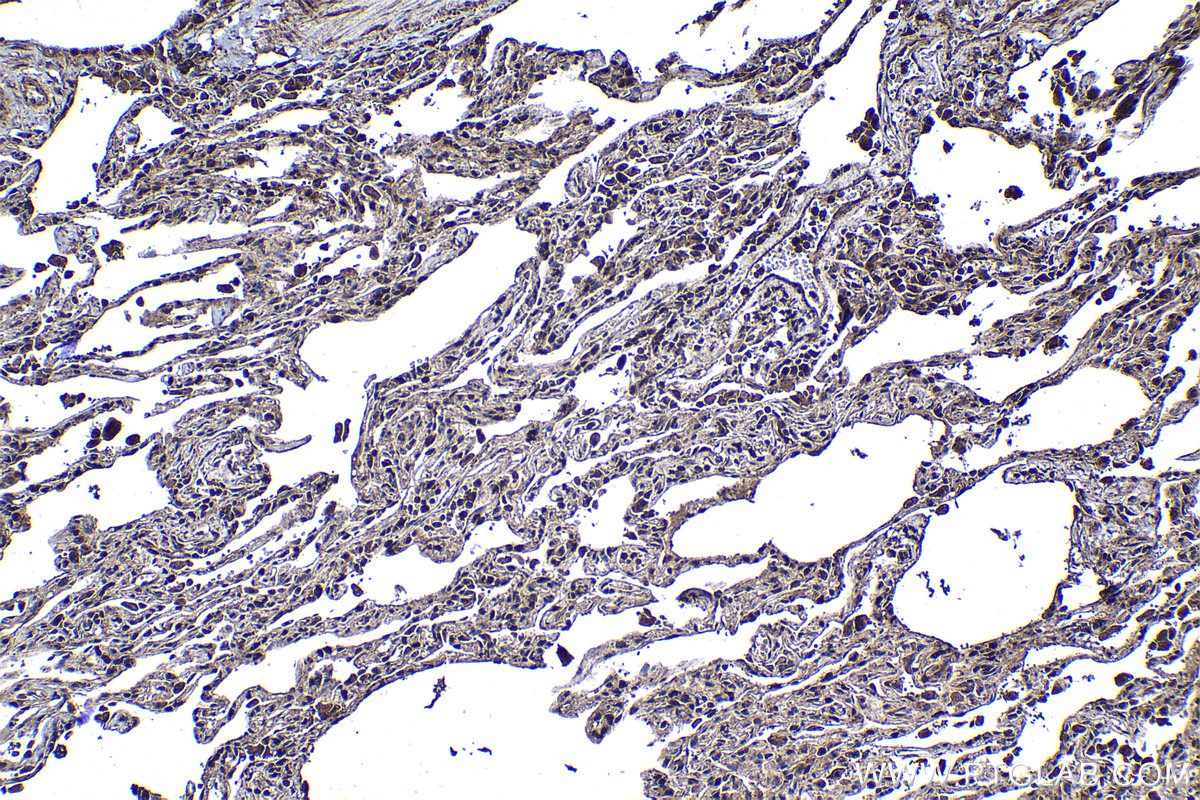 Immunohistochemical analysis of paraffin-embedded human lung tissue slide using KHC1177 (TRIM21 IHC Kit).